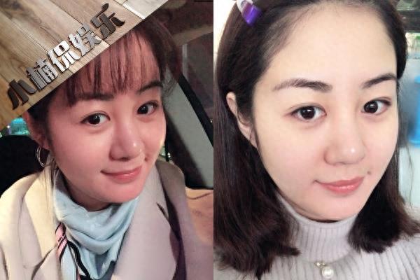 28岁毕畅近照,演《乡村爱情》王小蒙走红,嫁富豪老公