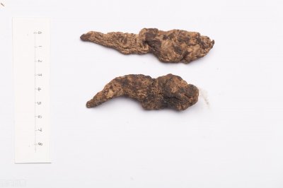 ​运用李可老中医经验方：乌蛇荣皮汤，治疗银屑病