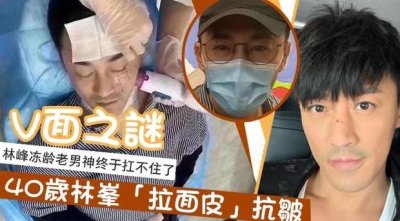 ​40岁林峰被曝做医美手术？“拉皮”后效果立竿见影，展现小V脸