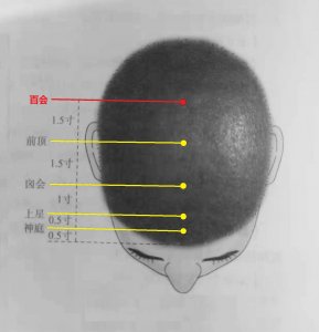 ​百会穴的妙用