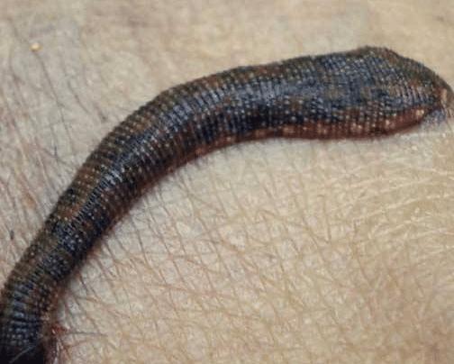 蚂蟥一种让人又爱又恨的生物,这种蚂蟥如果被误食在人体内能繁殖