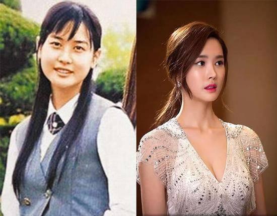 李多海整形前后 网友直呼变美了